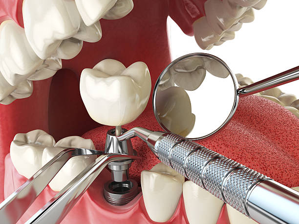 Best Mobile Emergency Dentist in Fair Oaks, VA